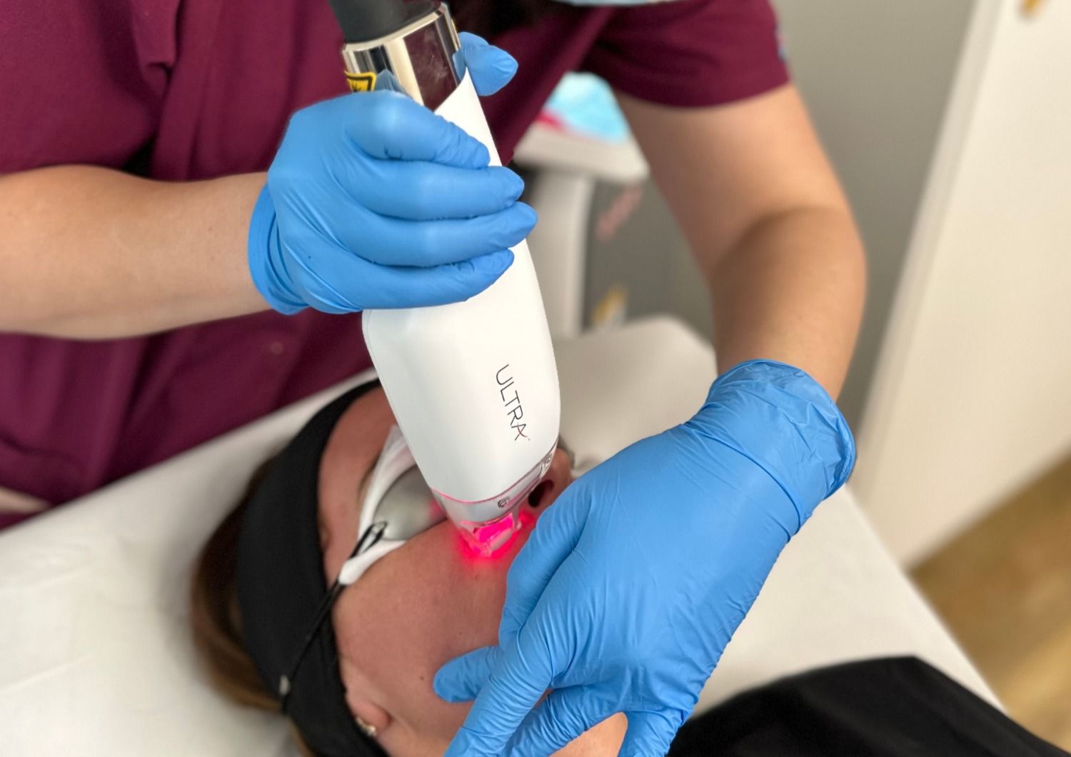 Le laser LaseMD Ultra Thulium pour un visage radieux