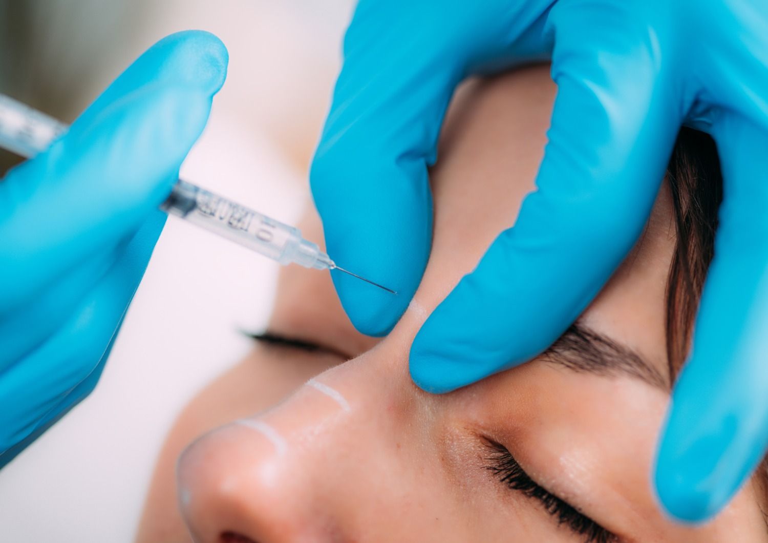 Rhinoplastie Médicale