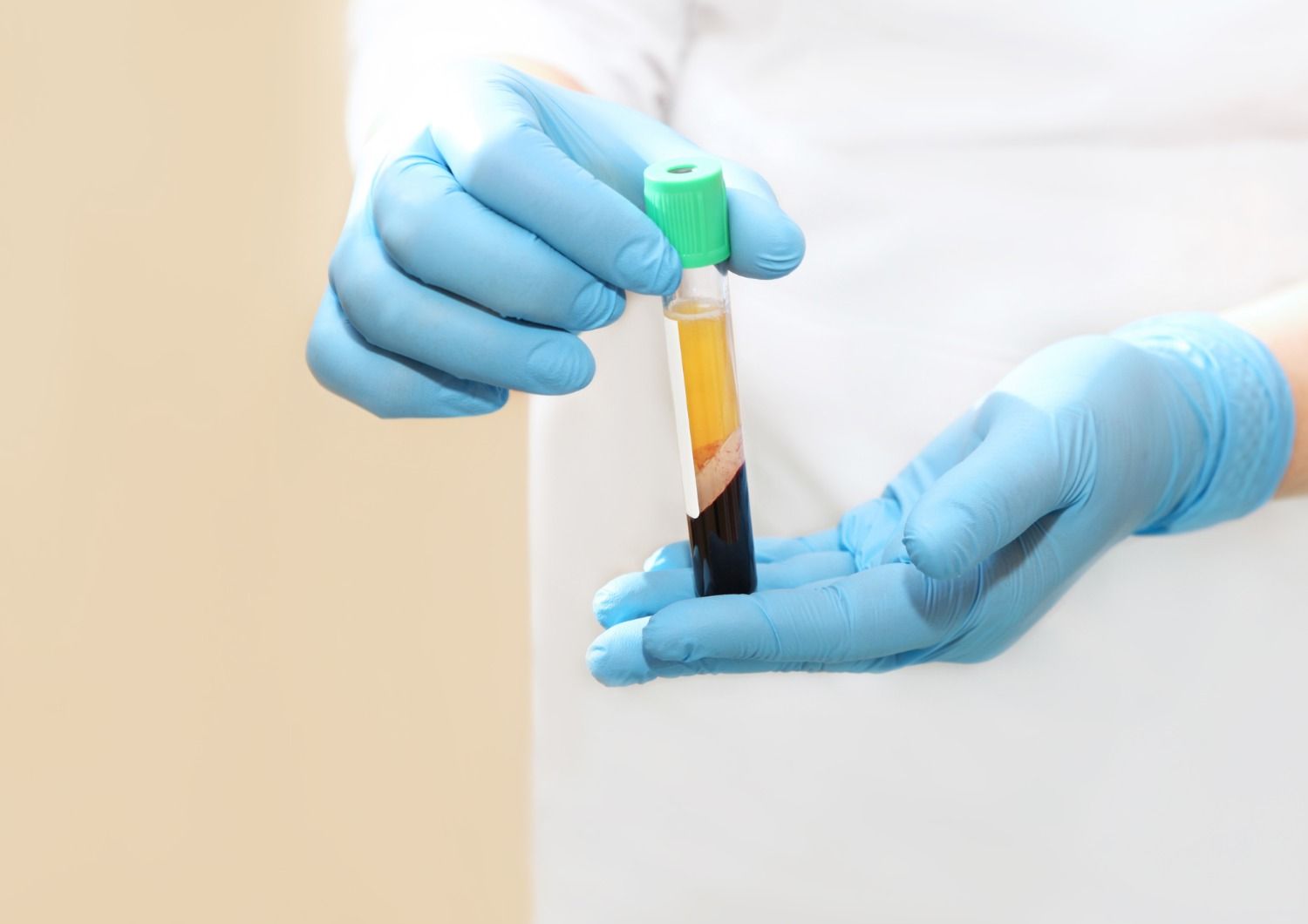 the PRP - Vampire LIft