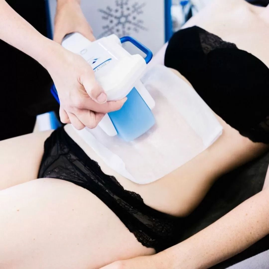 Cryolipolysis