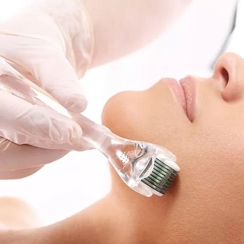 le microneedling