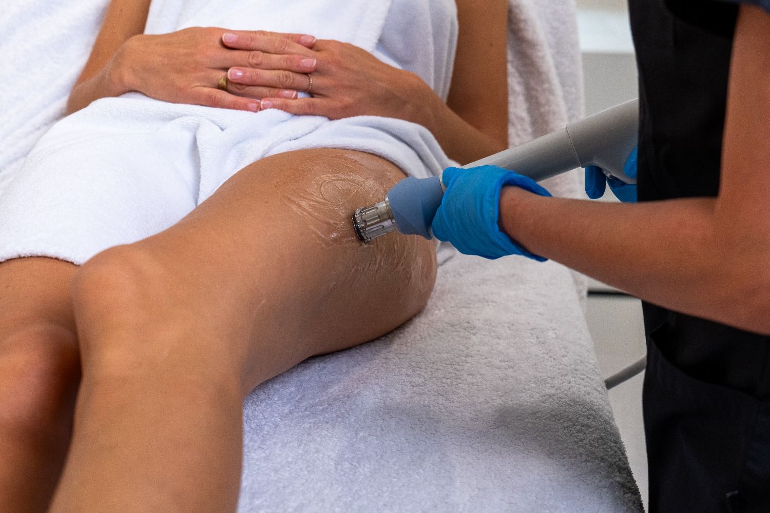 Présentation des ondes de chocs X-WAVE