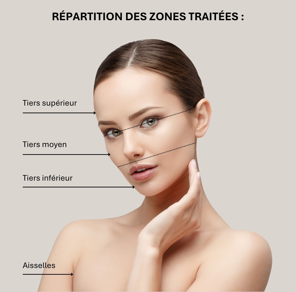AREAS TREATED BY BOTULIC TOXIN INJECTIONS