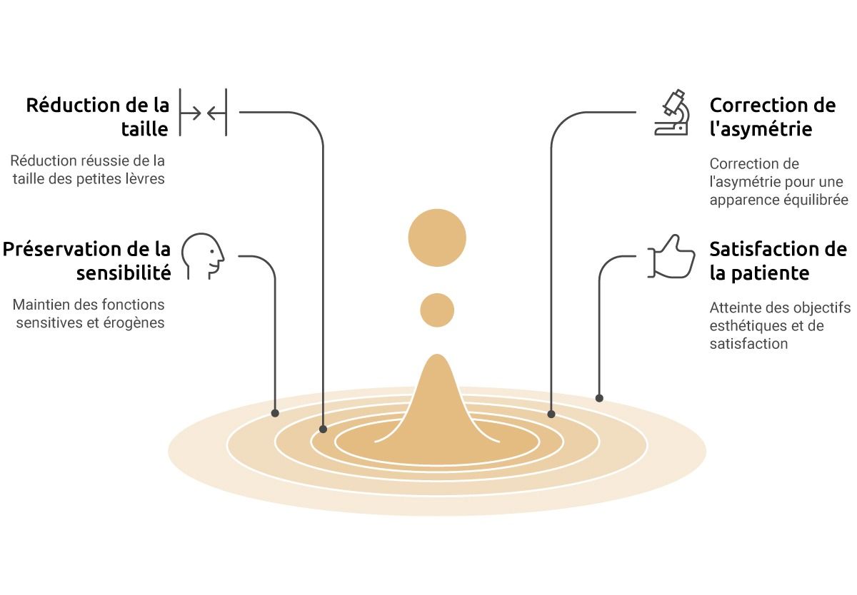 chirurgie_intime_feminine_tout_savoir_sur_la_nymphoplastie