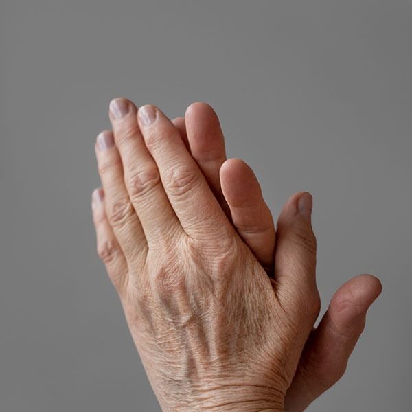 taches_pigmentaires_et_melasma_comment_les_reconnaitre_et_les_traiter_