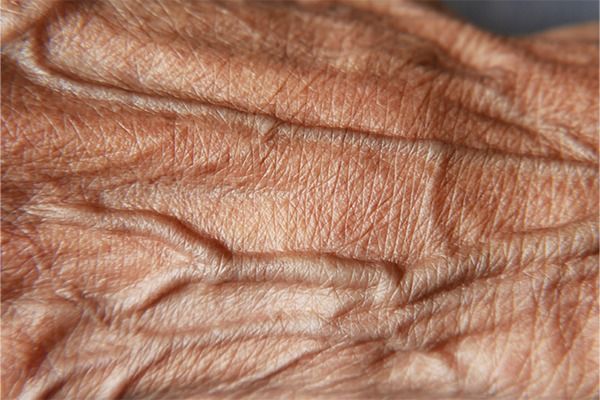 mains_et_decollete_les_zones_qui_trahissent_l_age_et_comment_les_traiter