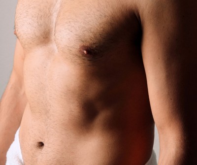 À qui se destine la chirurgie de la gynécomastie ?