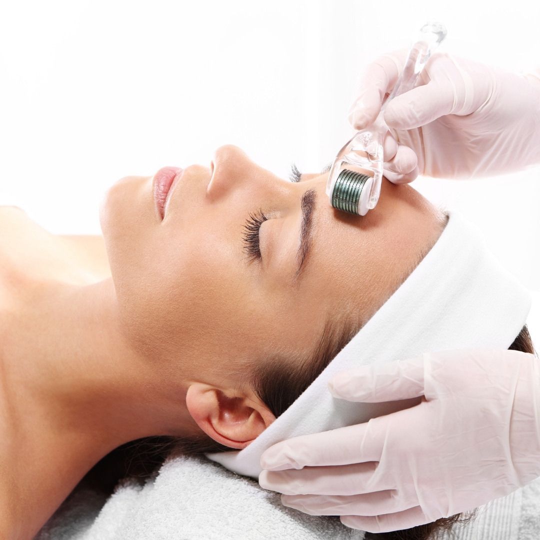 LE MICRONEEDLING