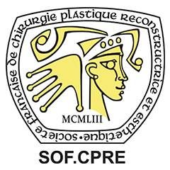 SOFCPRE
